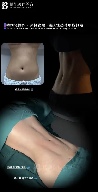 腰腹轮廓调整 · BOKAI