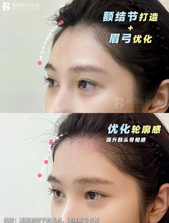 额部与眉弓轮廓 · BOKAI