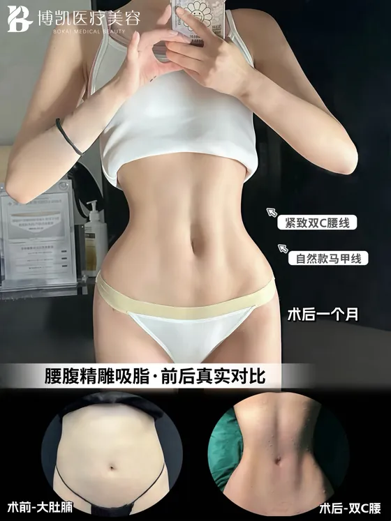 腰腹塑形 · 一个月记录 · BOKAI